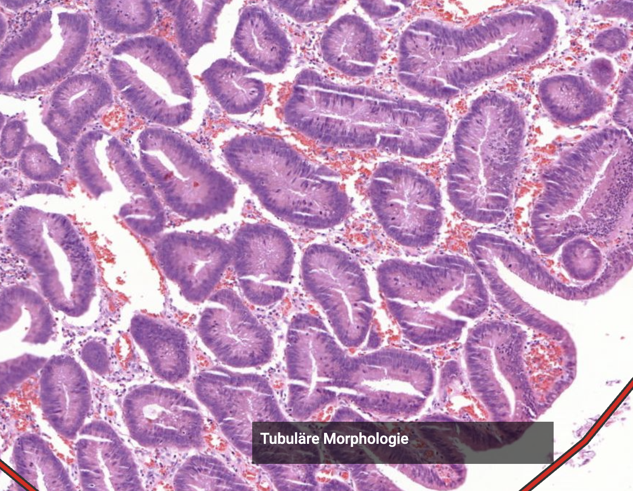 Histopathologisches Bild: Kolonschleimhaut